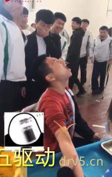 抽血惊吓表情包